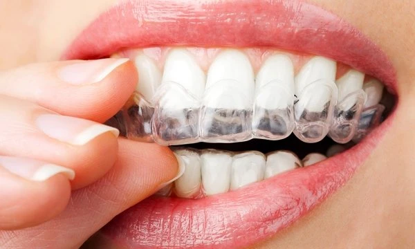 Bruxismo do sono - saiba como evitar as dores e desgastes dos dentes