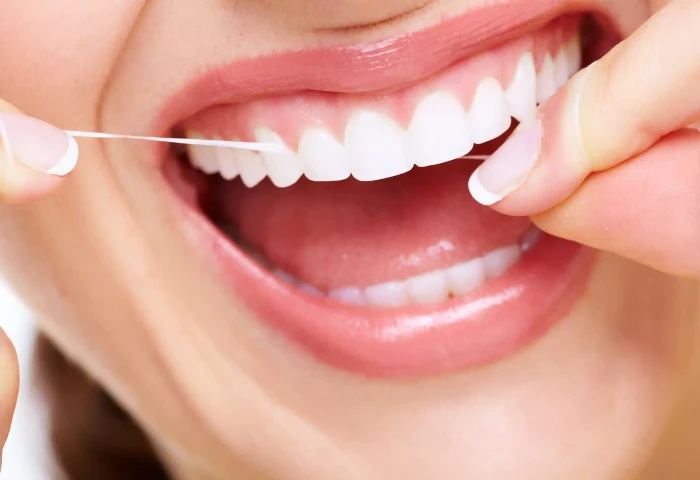 Cuidados e manutenção para lentes de contato dental